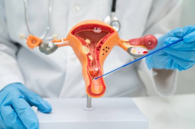 Vajinal ve rahim boynu sıvısı testi için rahmi tutan doktor doğum ve jinekolojiyi kontrol etti..