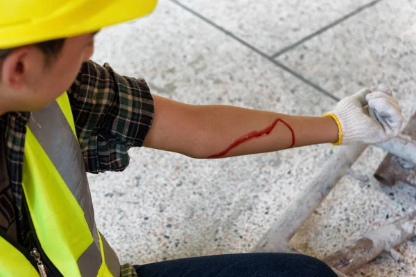 Injury bleeding from work accident in pile of scaffolding steel falling down to impinge the arm of young builder.