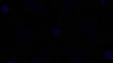 Psikedelik Kaleydoskop Patlaması simetrik kaleydoskop şekilleri patlıyor ve canlı renklerle beatendly döngülerde şekil değiştiriyor