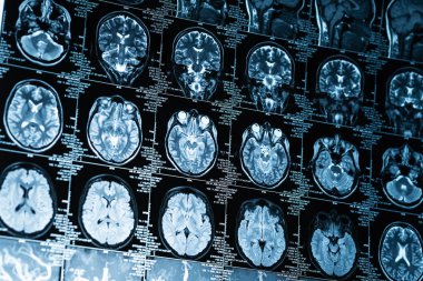 Beyin ve konsept MRI görüntülerinin yakın çekim serisi