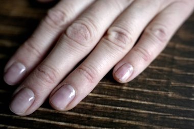 Dört parmaklı bir kadın elinin yakın çekimi. Tırnakları tamamen çıplak ve tek tırnak cilası ile kaplıdır. Küçük hasarlar veya kusurlar gösterir.