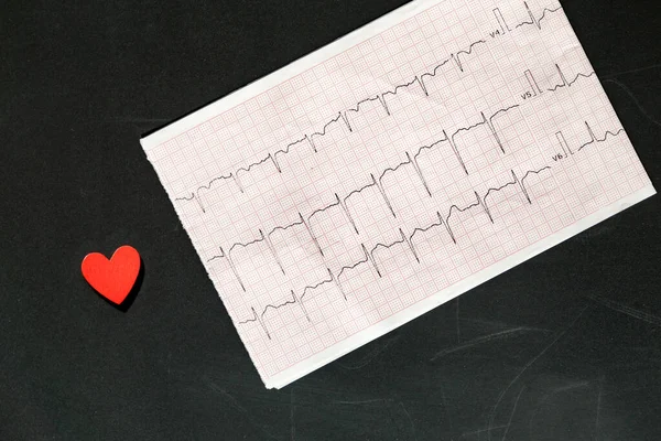 Top view of an electrocardiogram in paper form vith red wooden heart. ECG or EKG paper on black  background.  medical and healthcare concept.