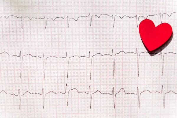close up of an electrocardiogram in paper form vith red wooden heart. ECG or EKG paper background.  medical and healthcare concept.