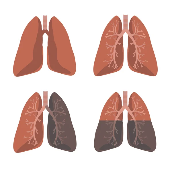 Human Lung anatomi. Ställ in vektor — Stock vektor