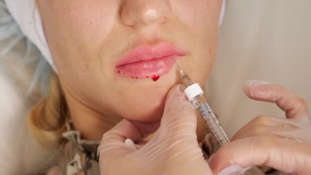 Profissional cirurgião cosmético injeta mulher madura lábio perto — Vídeo de Stock