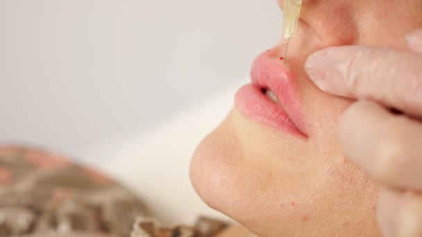 Cirujano cosmético profesional inyecta labios de señora con jeringa — Vídeos de Stock