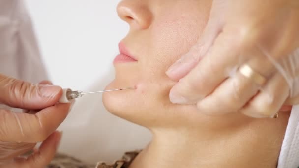 Cirurgião cosmético profissional injeta bochecha jovem mulher — Vídeo de Stock