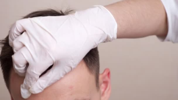 Медичний фахівець з рукавичками малює пунктирну лінію на голові облизуючого чоловіка — стокове відео