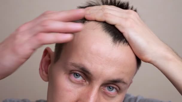 युवा आदमी दर्पण में अपने बालों वाली धब्बे की जांच करता है — स्टॉक वीडियो