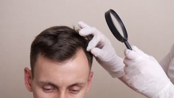 Medisch werker in handschoenen en met een vergrootglas onderzoekt het hoofd van een kalende man close-up — Stockvideo