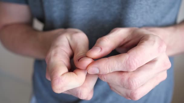 Młody mężczyzna zarysowuje paznokieć na palcu cierpiącym na neurozę — Wideo stockowe