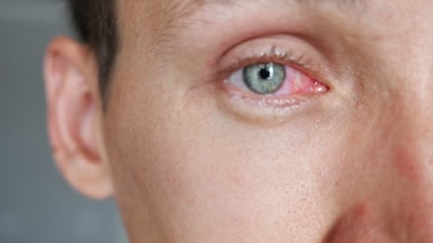 Primer plano de una cara masculina con ojos rojos — Vídeos de Stock