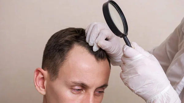 Медицинский работник в перчатках и с увеличительным стеклом осматривает голову лысого крупным планом — стоковое фото
