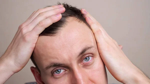 Homem examina um ponto careca em sua cabeça em um espelho em câmera lenta — Fotografia de Stock
