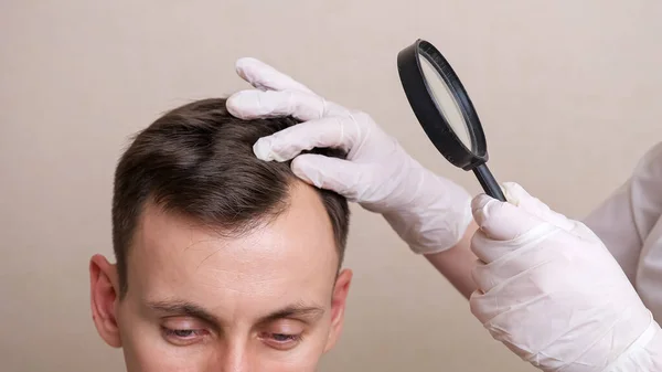 Lekarz w rękawiczkach i szkle powiększającym bada głowę młodego mężczyzny — Zdjęcie stockowe