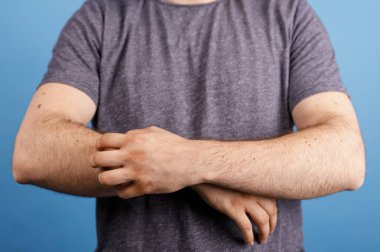 Kolu kaşınan bir adam, kaşıntı ya da kaşıntıdan rahatsız oluyor, mavi arka plan.