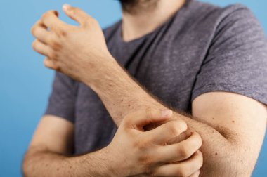 Kolunu kaşıyan bir adam, sinirlenmiş ve kaşınıyor, mavi arka plan, alerji konsepti.