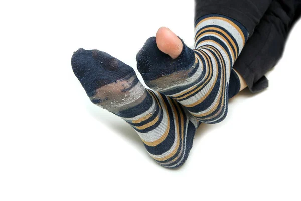 Ноги Хорошо Изношенными Полосатыми Носками Изолированы Белом Фоне Нем Дырка — стоковое фото