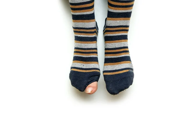 Ноги Добре Зношеними Смугастими Шкарпетками Ізольовані Білому Тлі Людини Дірка — стокове фото