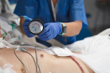 Hastane yoğun bakım ünitesinde hastaların merkezi venöz basıncını kontrol eden hemşire.