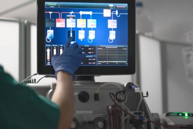 Tıbbi personel, sürekli böbrek yenileme terapi cihazının ayarlarını ayarlıyor.