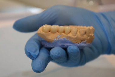 Diş cerrahisi aletleri. Diş cerrahisi aletleri. Diş bakımı. Yüksek kalite fotoğraf