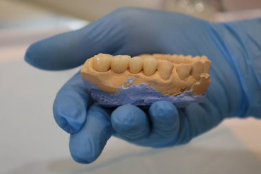 Diş cerrahisi aletleri. Diş cerrahisi aletleri. Diş bakımı. Yüksek kalite fotoğraf