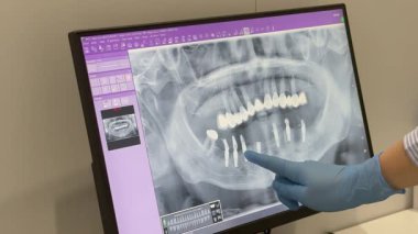 Diş röntgeni muayenesi. Diş hekiminin ofisinde. Yüksek kalite 4k görüntü