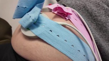 Hamile karnındaki doğum öncesi gözlem sensörlerinin yakın çekimi. Hamilelik boyunca tıbbi bakım konsepti, annelik sağlığı ve fetal izleme