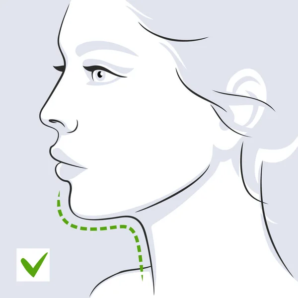 Γυναίκα προφίλ πρόσωπο διπλό πηγούνι μετά την διανυσματική απεικόνιση — Διανυσματικό Αρχείο