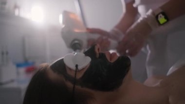 Genç ve güzel bir kızın yüzünün karbonu soyuluyor. Cilt bakımı kozmetolojisi. Lazer terapisi ve cilt tedavisi.