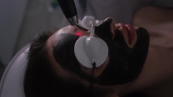 Kohlenstoff-Peeling des Gesichts eines jungen schönen Mädchens. Kosmetik der Haut. Lasertherapie und Hautbehandlung. — Stockvideo