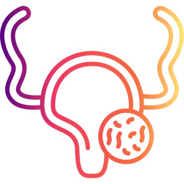 Bu tıbbi ikon özellikle rahmin dış duvarına iliştirilmiş büyük bir fibroid ya da kisti vurgulayan dişi üreme sistemini içerir..