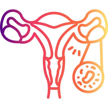 Yumurtalık Kisti Asgari Düz Vektör İllüstrasyonu