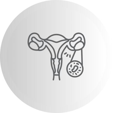 Kadın üreme sistemi anatomisini gösteren diyagram