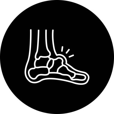 Ayak bileği ekleminin basit bir taslağı.