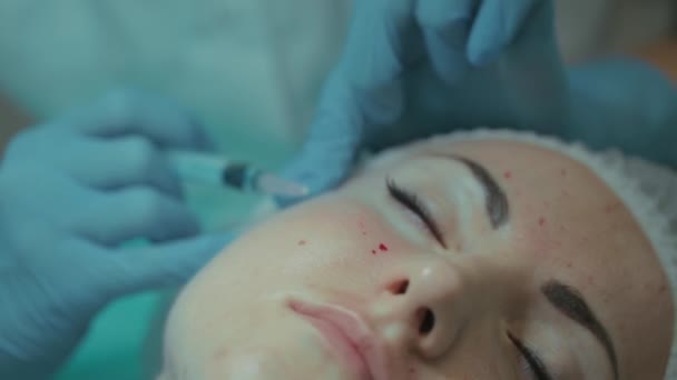 O esteticista faz um procedimento de tratamento para o paciente. Um esteticista dá injeções a um rosto de mulher. Mesoterapia. Médico em luvas médicas injectadas injecções — Vídeo de Stock
