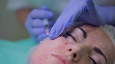 Güzellik uzmanı hastaya bir tedavi prosedürü uygular. Bir güzellik uzmanı bir kadının yüzüne iğne yapar. Mezoterapi. Tıbbi eldivenli doktor enjeksiyonlu