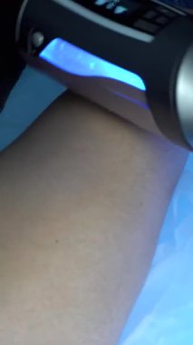 Endospheres Bacak / Karında Anti-Selülit Tedavisi