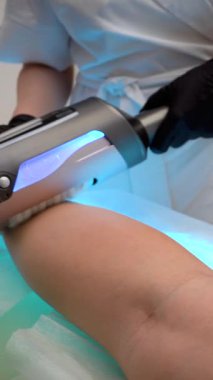 Endospheres Bacak / Karında Anti-Selülit Tedavisi