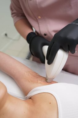 Koltuk altı kılları için Kozmetik Lazer Tedavisi