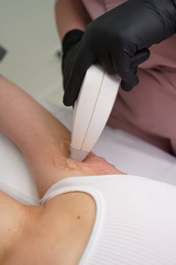 Koltuk altı kıllarını lazerle küçültme