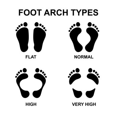 Set of flat foot, high arch clipart