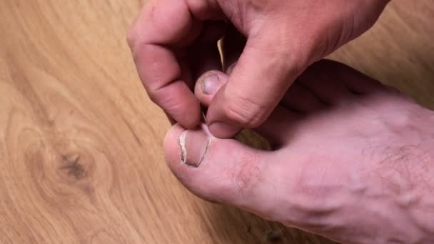Cortar as unhas dos pés. homem fazendo um pedicure em seus pés — Vídeo de Stock