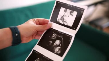 Üç boyutlu ultrason görüntüsü taşıyan kadın eller. Annelik, hamilelik ve aile kavramı.