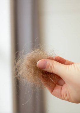 Ellerinde yaralı, düşmüş saçlar tutan genç bir kadın. Saç dökülmesi, aşırı dökülme, saç dökülmesi, stres, hormonal dengesizlik ve sağlık sorunları kavramı.