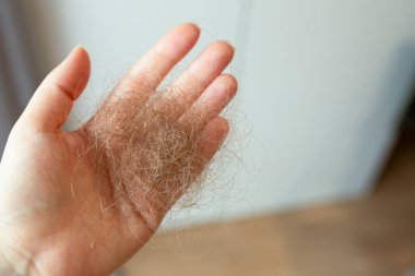 Düşmüş insan saçından bir tutam tutan bir kadının yakın çekimi. Saç dökülmesi, aşırı dökülme, saç dökülmesi, stres, hormonal dengesizlik ve sağlık sorunları. Işık arkaplanı ile izole edilmiş