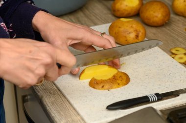 Beyaz plastik bir kesme tahtasının üzerinde çiğ patatesi dilimleyen ellerin yakın çekimi. Bu resim, kızarmış veya kızarmış patates yemeği hazırlamada temel bir adımı gösteriyor.