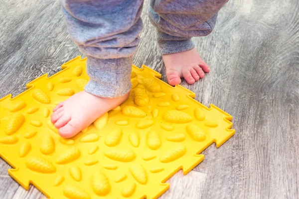 Pies Niño Alfombra Ortopédica Cerca Concepto Valgus — Foto de Stock