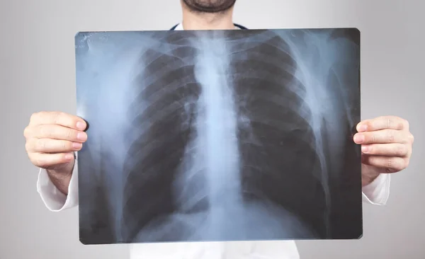 Caucasian doctor looking at xray. Lungs examination